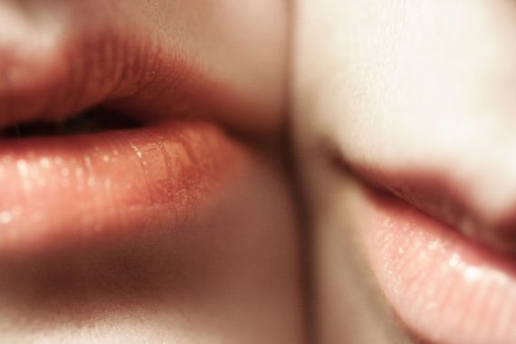 laser hair removal, Unwanted Facial hair, Hirsutism